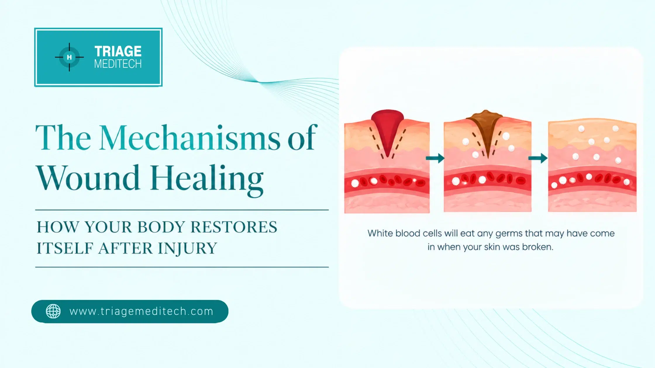 The Mechanisms of Wound Healing