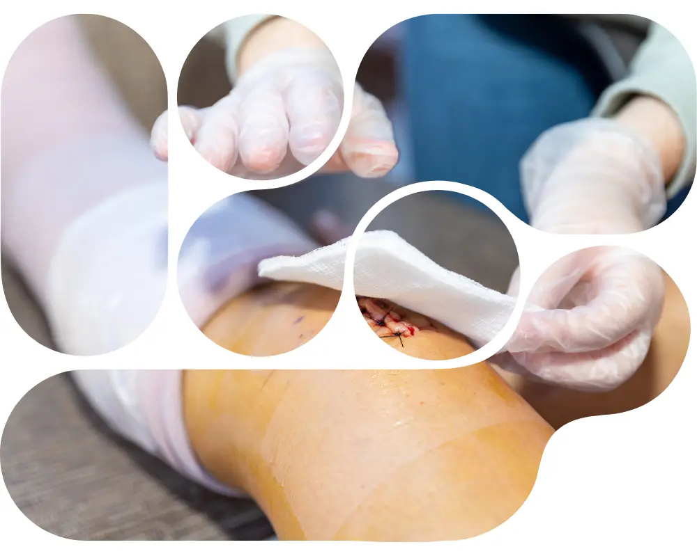 Advancing Wound Care with Scientific Innovation Advancing Wound Care with Scientific Innovation