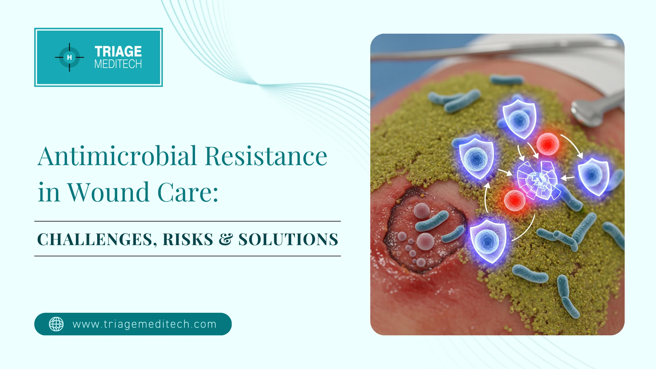 Antimicrobial Resistance in Wound Care: Challenges, Risks & Solutions