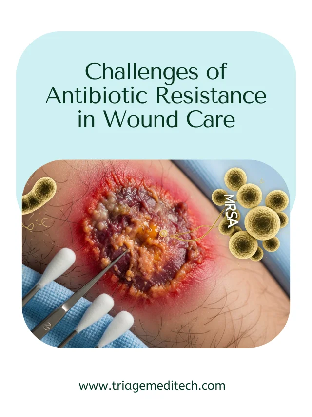 Challenges of Antibiotic Resistance in Wound Care