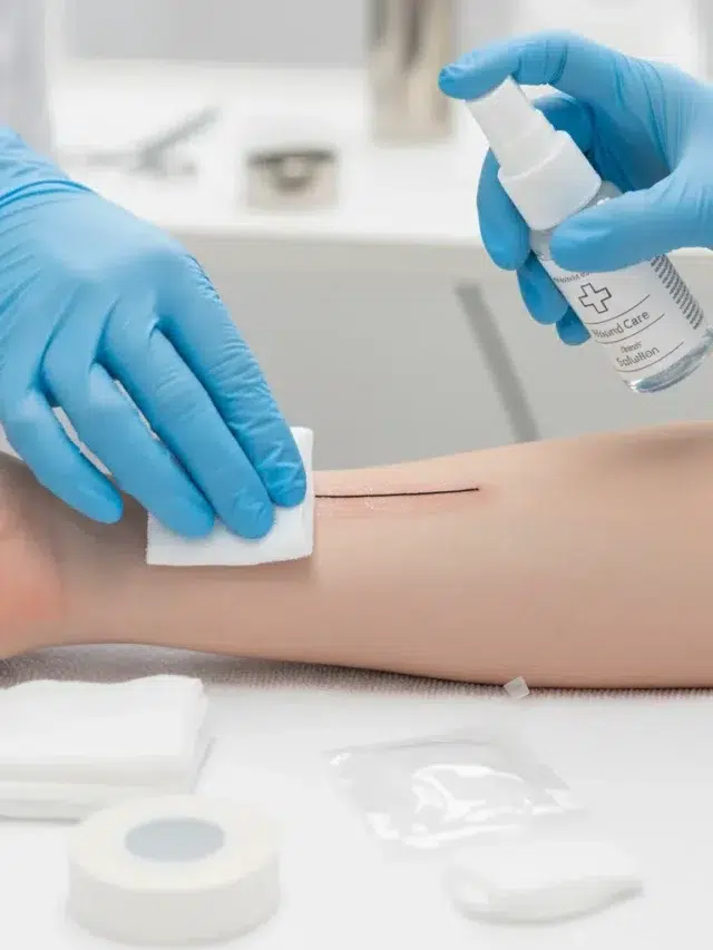 Suture Care: 3 Warning Signs of Infection
