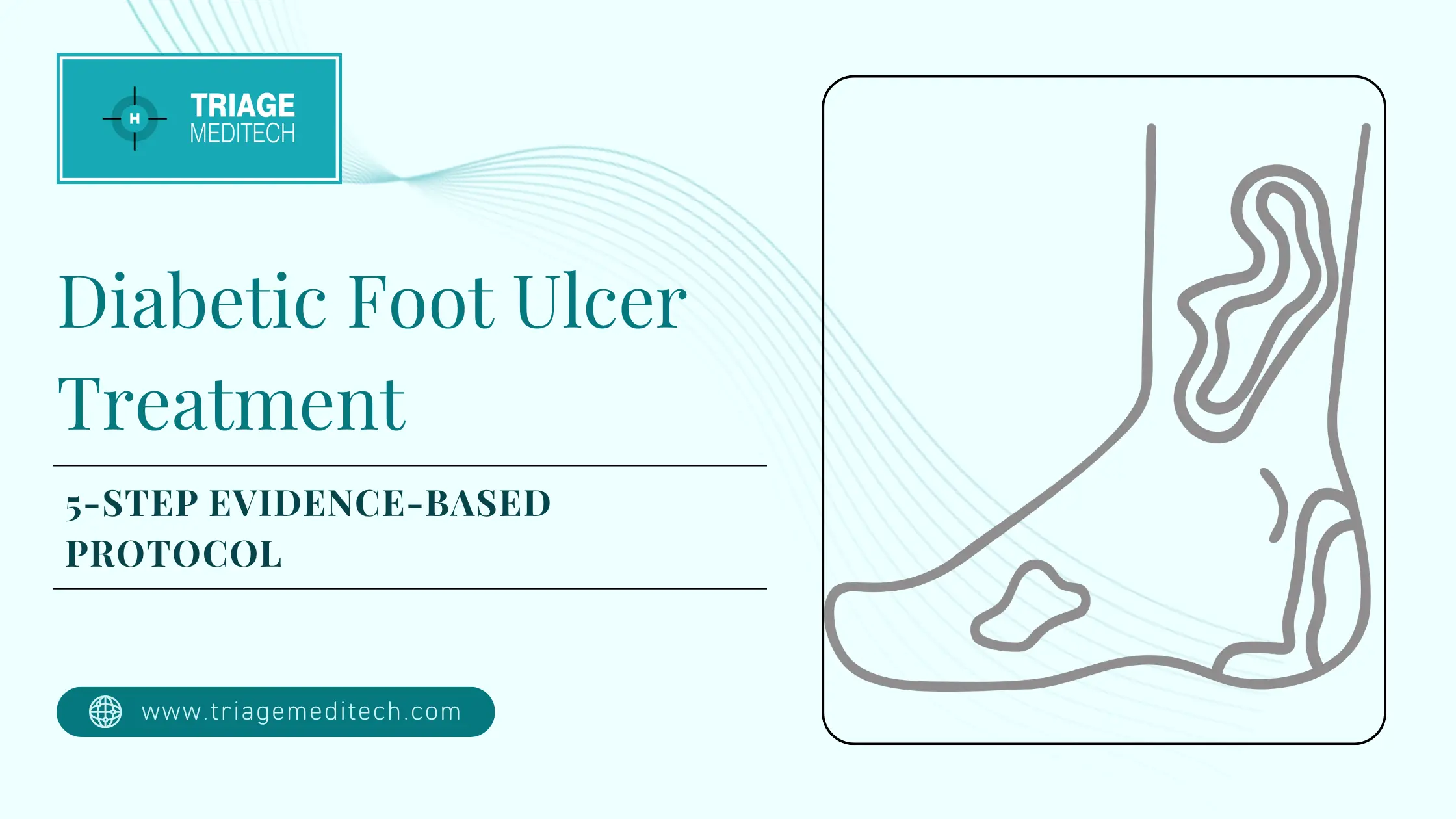 Diabetic Foot Ulcer Treatment