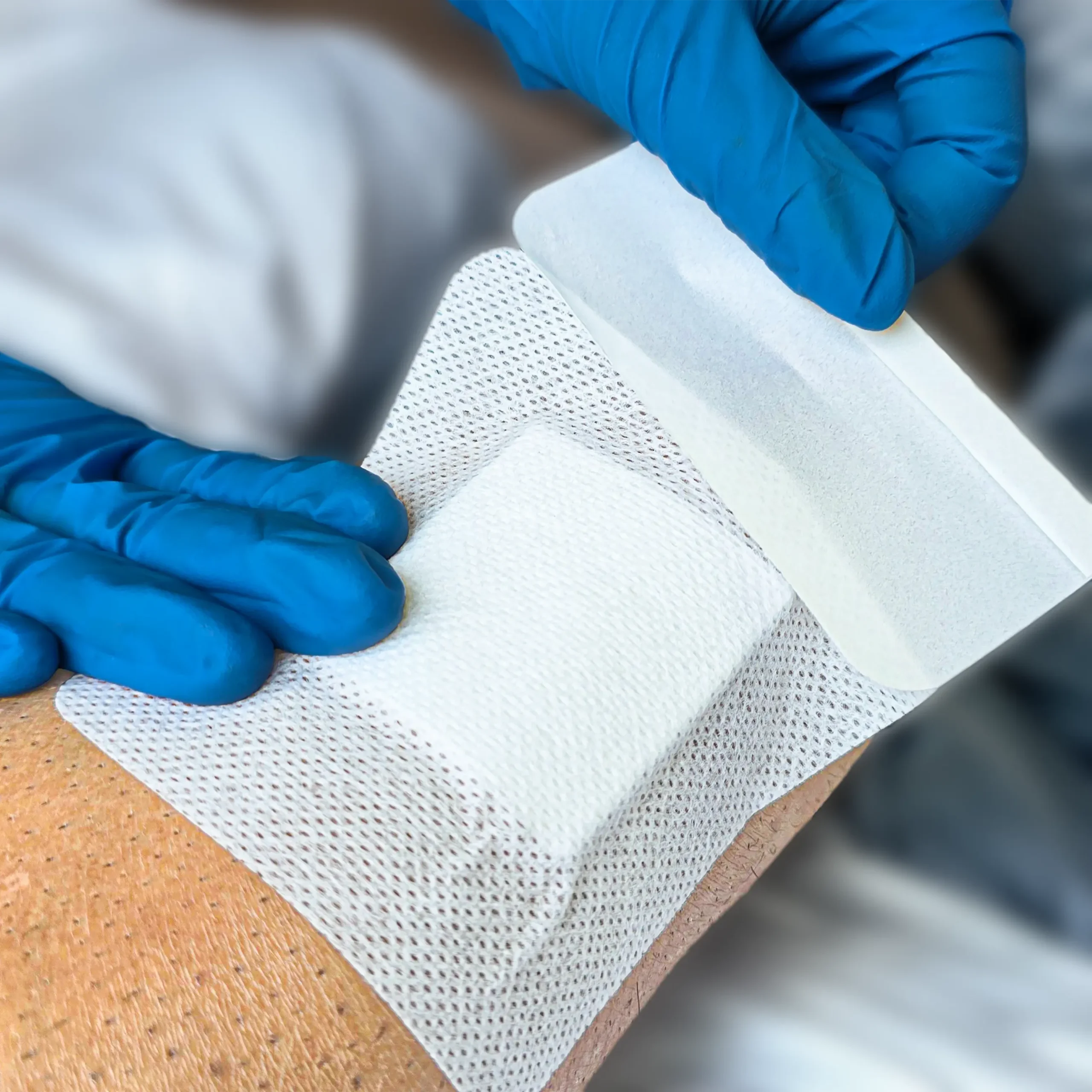 Application Permesorb™ Non woven Surgical Dressing 10cm x 10cm NW1010 scaled Permesorb™-Non-woven-Surgical-Dressing-10cm-x-10cm_NW1010