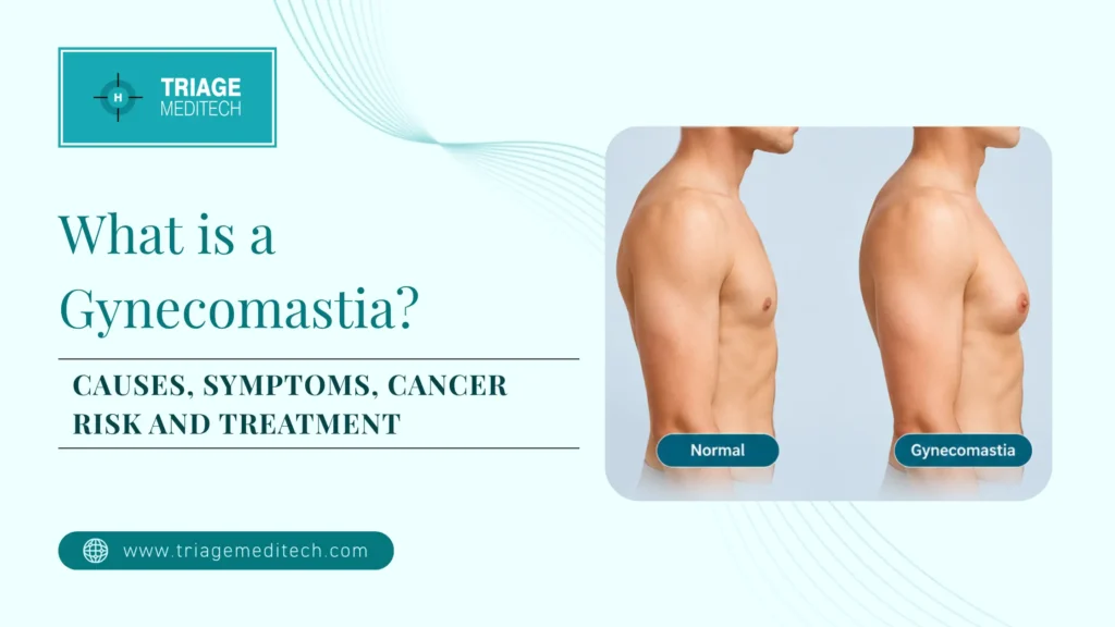 What is Gynecomastia